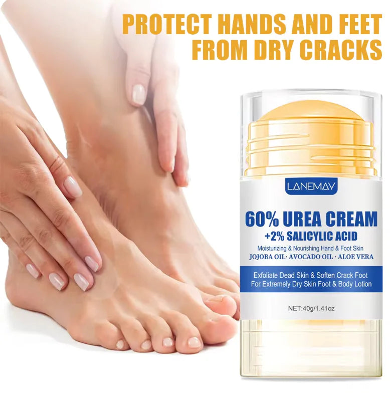 Foot Cream for Softening and Exfoliating Dry, Cracked Hands and Feet